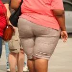 Bendaggio gastrico: cos'è e perché dovrebbe essere l'ultima spiaggia