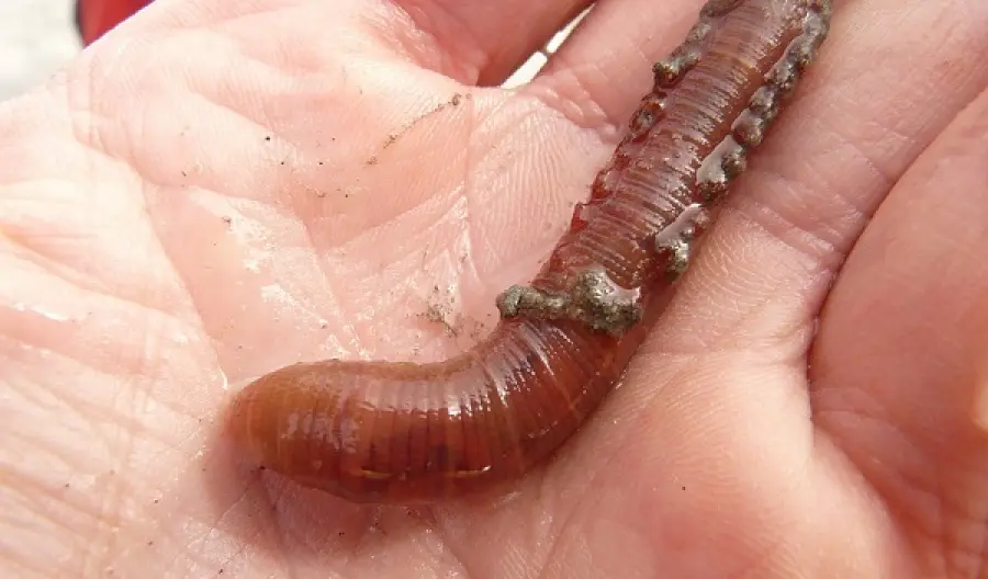 India: estratto dall'occhio un verme di 15 centimetri (VIDEO)