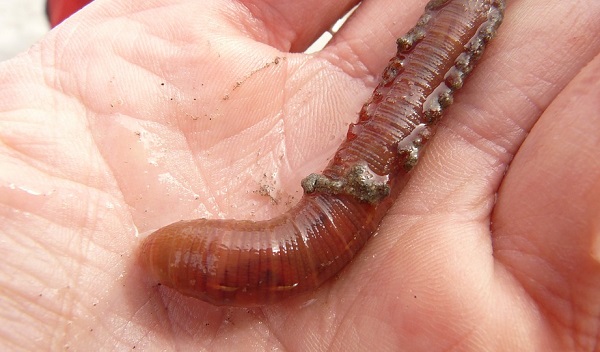 India: estratto dall'occhio un verme di 15 centimetri (VIDEO)