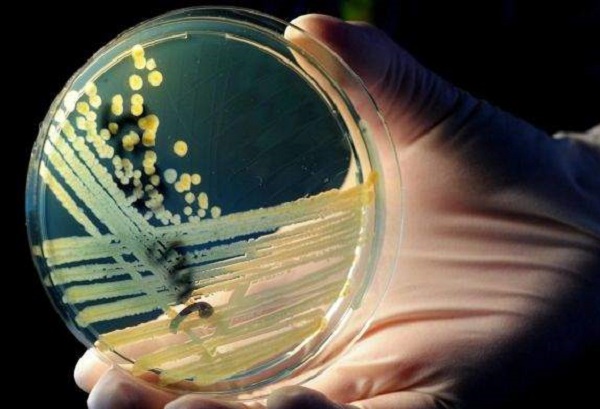 Antibiotici: un nuovo laser ha individuato i killer del farmaco