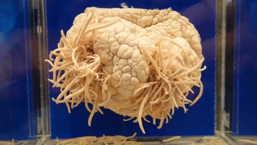 Ameba mangia-cervello: morto 29enne negli Stati Uniti