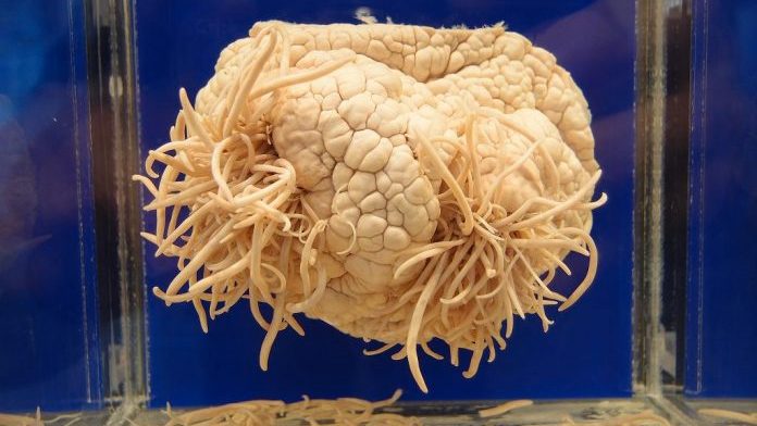 Ameba mangia-cervello: morto 29enne negli Stati Uniti