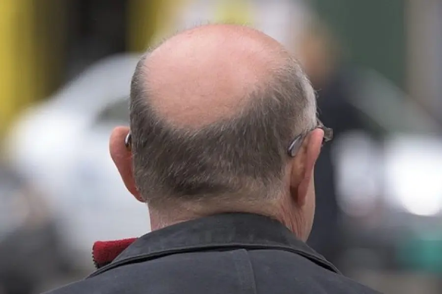 Cura per la calvizie, un profumo fa ricrescere i capelli