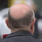 Cura per la calvizie, un profumo fa ricrescere i capelli