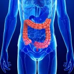 Malattia di Crohon, arriva il sito online Ragazzi Coraggiosi