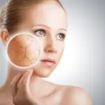 Rimedi per pelle secca e squamosa