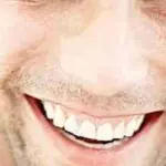 Non può sorridere per 35 anni - oggi esprime le sue prime emozioni dopo un intervento chirurgico