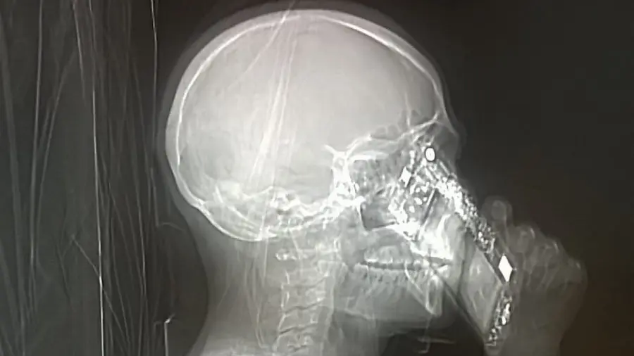 Tac con cellulare: medici stupiti scattano foto al paziente