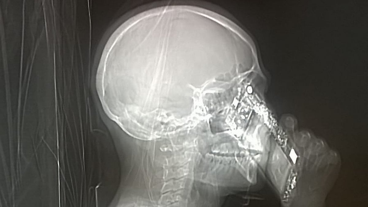 Tac con cellulare: medici stupiti scattano foto al paziente