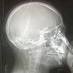 Tac con cellulare: medici stupiti scattano foto al paziente