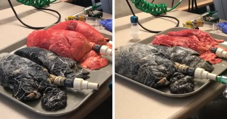 Polmoni sani vs polmoni di un fumatore: video scioccante