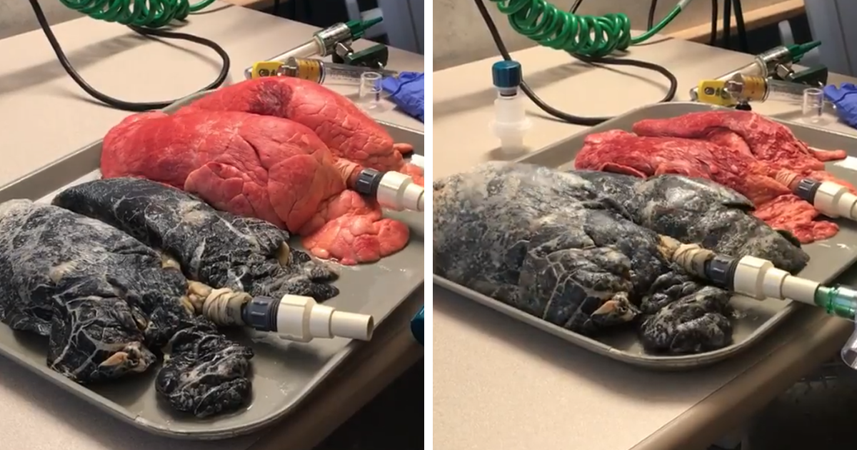 Polmoni sani vs polmoni di un fumatore: video scioccante