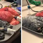 Polmoni sani vs polmoni di un fumatore: video scioccante