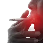 Tumore del cavo orale, un gesto semplice per scoprirlo in tempo