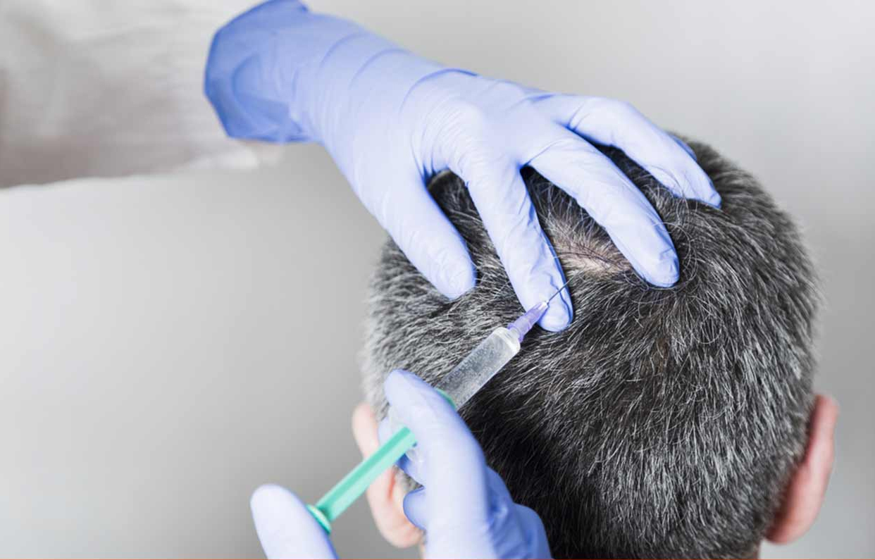 Calvizie addio con autofagia, effetto protettivo verso varie malattie