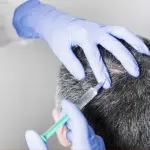 Calvizie addio con autofagia, effetto protettivo verso varie malattie