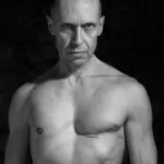 Uomo con tumore al seno: il caso di Stefano Saldarelli