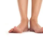 Alluce valgo: come alleviare il dolore in modo naturale
