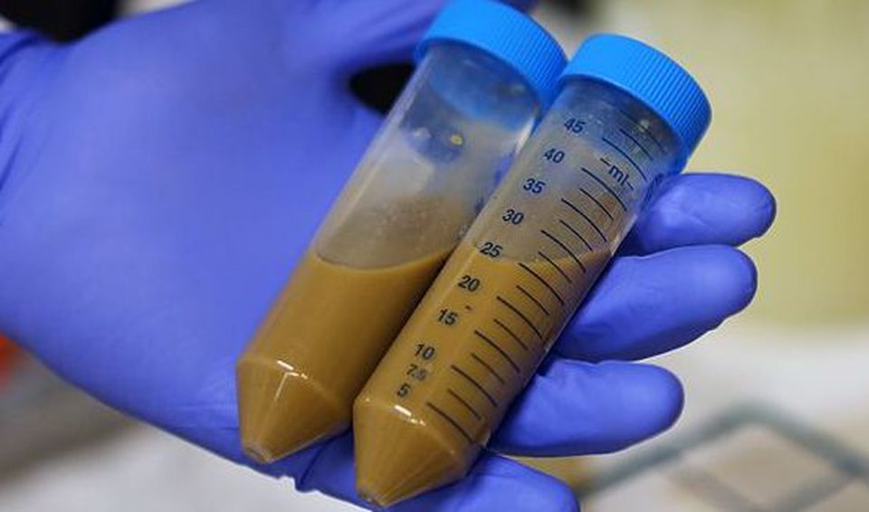 Trapianto di feci per curare morbo di Crohn e colite