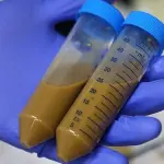 Trapianto di feci per curare morbo di Crohn e colite