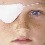 Ambliopia: bisogna veramente rassegnarsi all'occhio pigro?