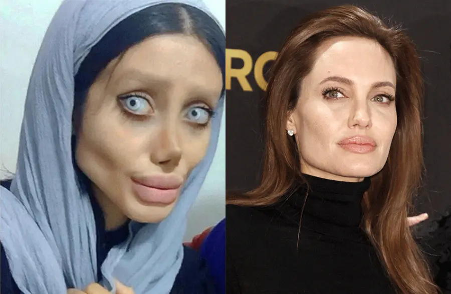 50 interventi chirurgici per somigliare ad Angelina Jolie, il suo idolo
