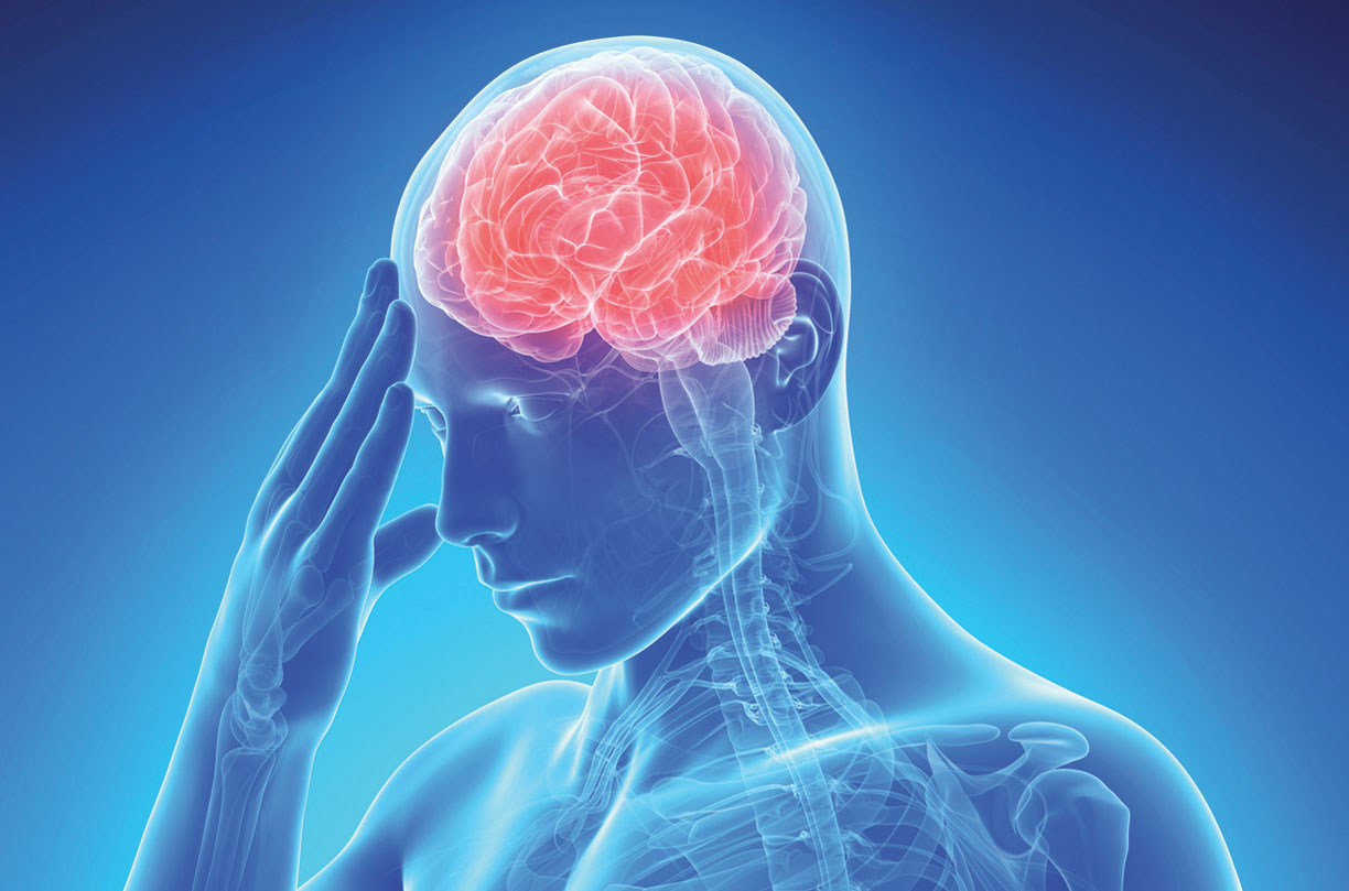 Ictus cerebrale seconda più probabile causa di morte nel mondo: i sintomi