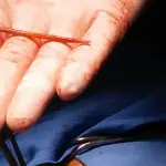 Viveva con uno stuzzicadenti nel cuore ma non sentiva dolore