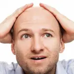 Calvizie news: mele annurche contro la caduta dei capelli