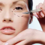 Cerchi un chirurgo plastico su Instagram? Attenzione