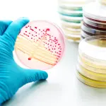 Gonorrea, allarme batterio potente: antibiotici inutili