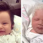 Bruciori di stomaco in gravidanza, neonato avrà tanti capelli