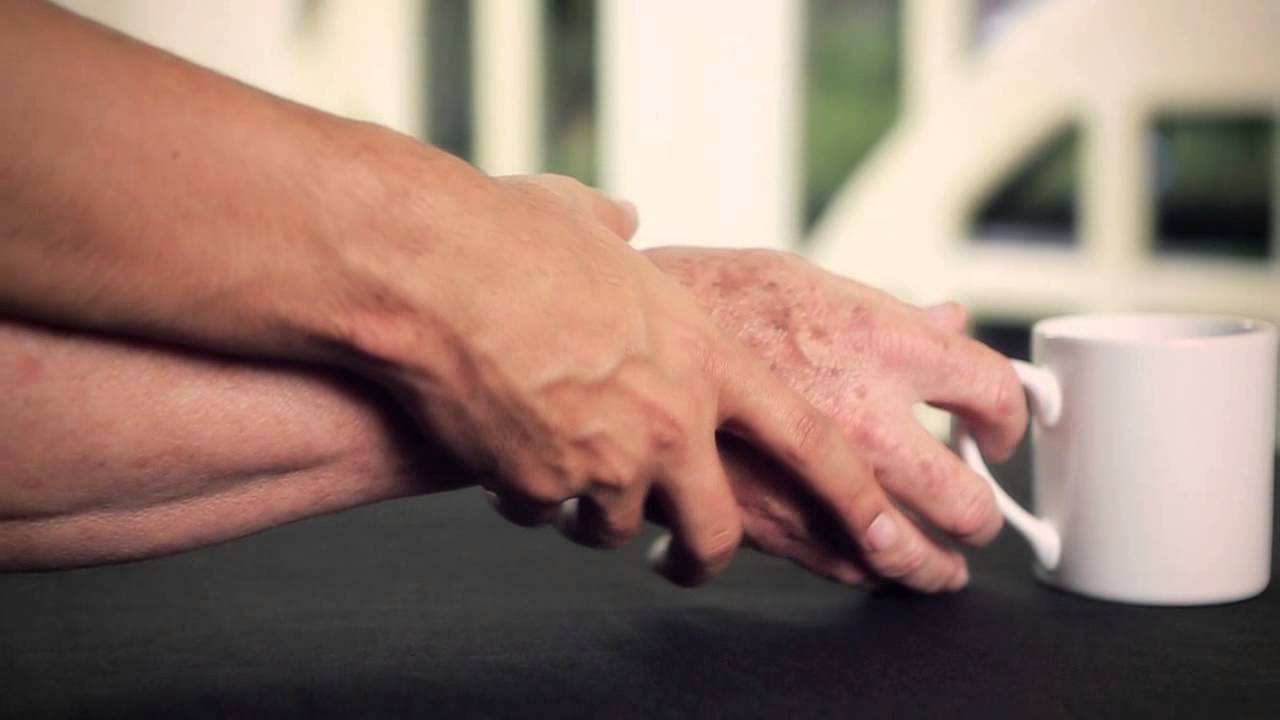 Morbo di Parkinson e disturbi intestinali: la malattia nasce nell'intestino?