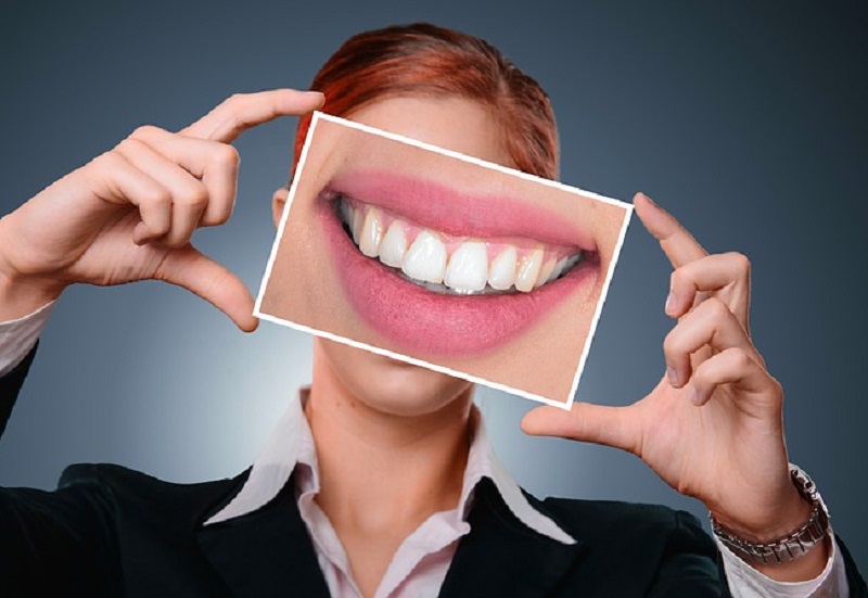 Denti: le strisce sbiancanti fai da te sono molto pericolose, i motivi