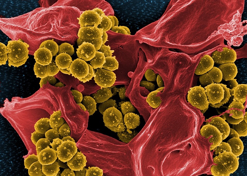 Allarme Candida auris: il fungo particolarmente resistente e difficile da eliminare