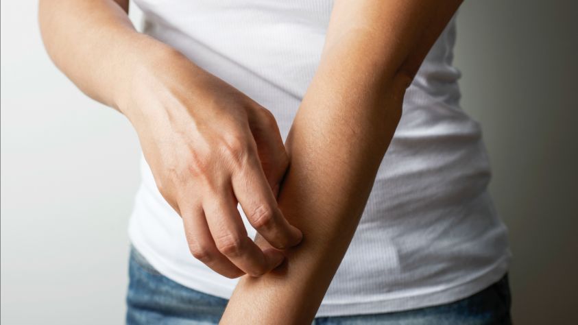 Psoriasi: diagnosi tardive e cure inadeguate in Italia