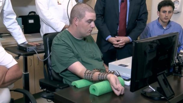 Tetraplegico muove mano grazie a microchip