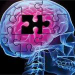 Alzheimer: capsula spazza via proteina beta-amiloide