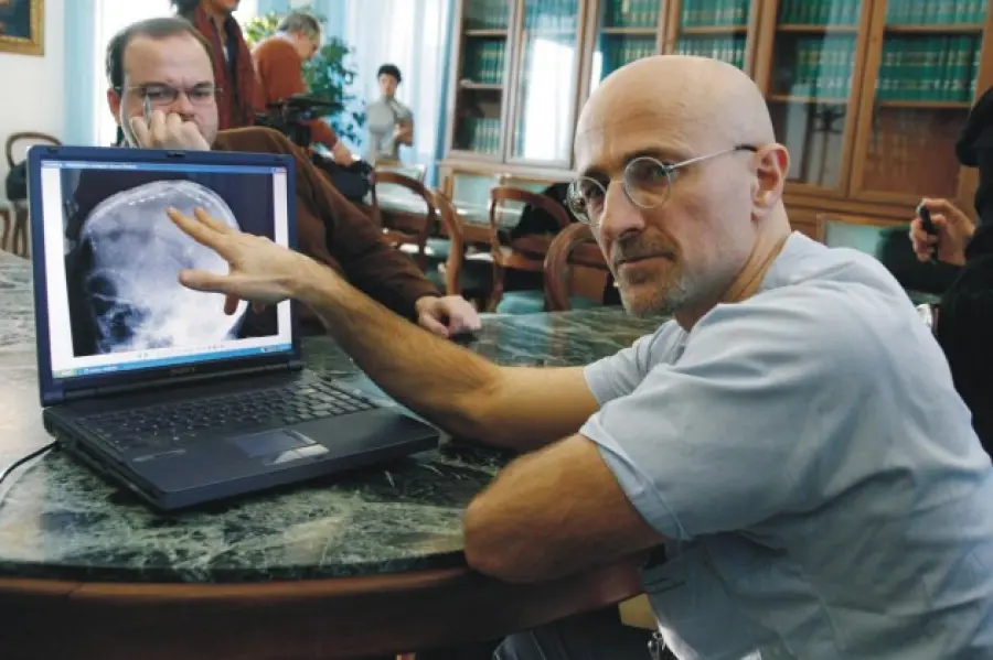 Trapianto di testa su una scimmia: tra salvezza e questioni etiche