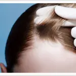 Medicina rigenerativa, l'amica della bellezza femminile