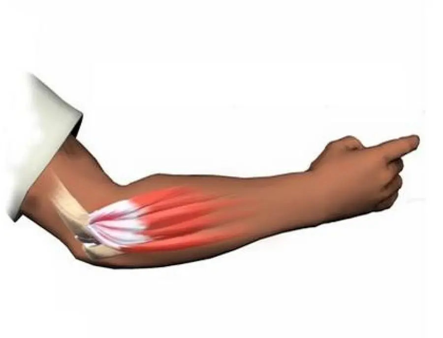 Trapianto di gomito preso da cadavere, paziente ora flette braccio