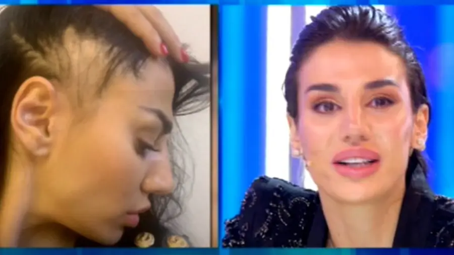 Patrizia Bonetti in lacrime dopo l'aggressione: "Adesso ho una protesi"