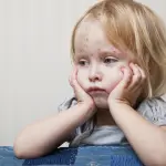 Morbillo, Boom Casi per Fuga dai Vaccini: Patologia Può Portare alla Morte