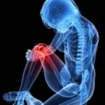 Fragilità Ossea in Aumento: Italiani Rischiano Fratture, più Sole e Sport