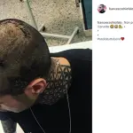 Francesco Chiofalo mostra la cicatrice su Instagram: 