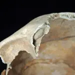 Scheletro del I secolo d.C. malato di cancro: la scoperta importante