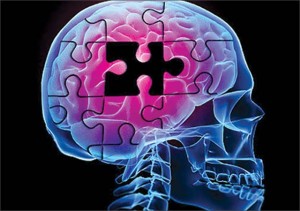 Alzheimer: capsula per pulire cervello