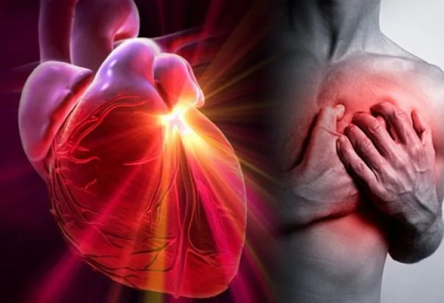 Infarto può sferzare anche under 60: obesità, ipertensione e diabete fattori di rischio
