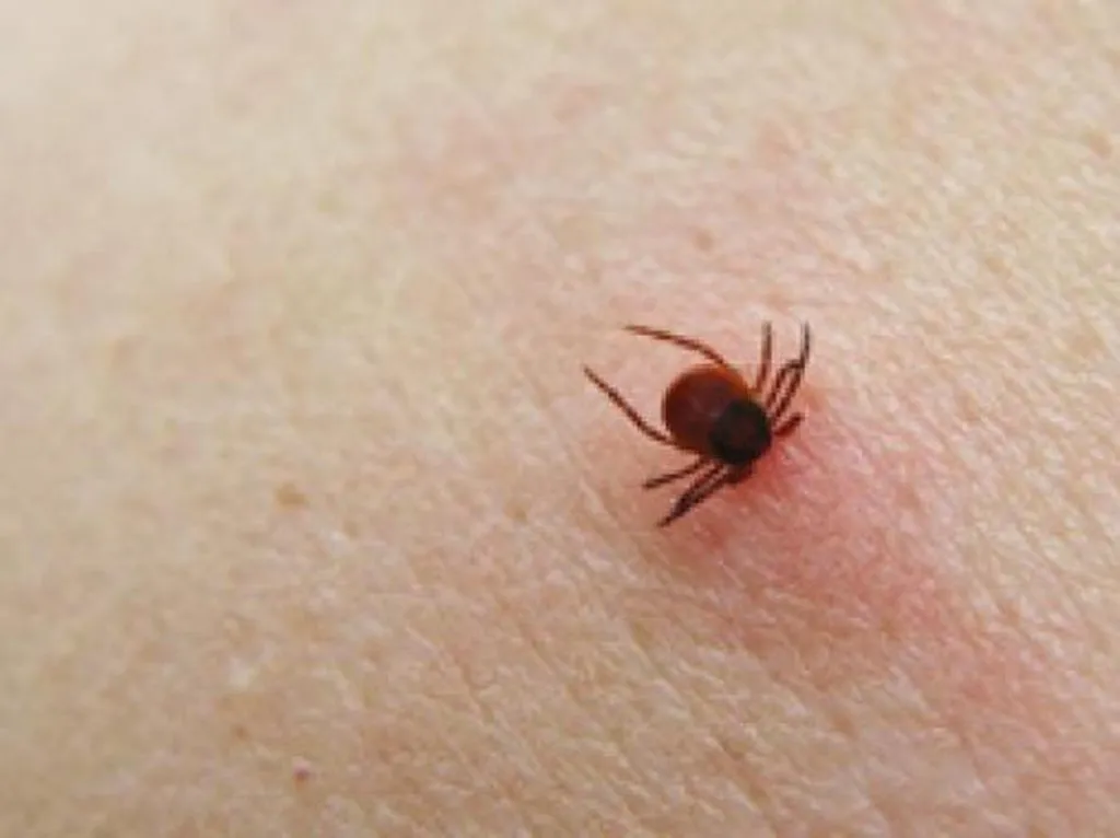 Allarme zecche a Belluno, 7 ricoverati per meningoencefalite: meglio vaccinarsi contro Tbe!