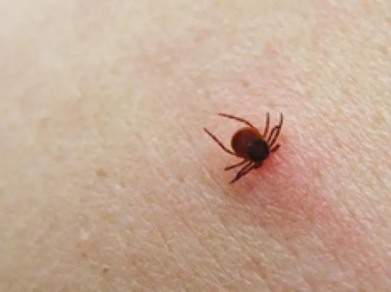 Allarme zecche a Belluno, 7 ricoverati per meningoencefalite: meglio vaccinarsi contro Tbe!